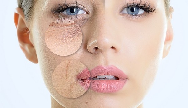 Take Control Of Your Aging Skin - Apollo Cosmetic Clinics
