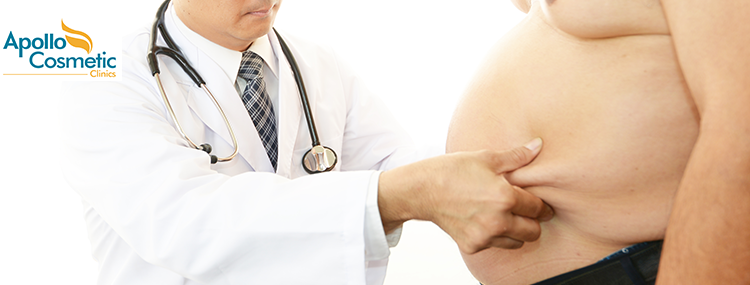 5 Myths about Tummy Tuck Procedure