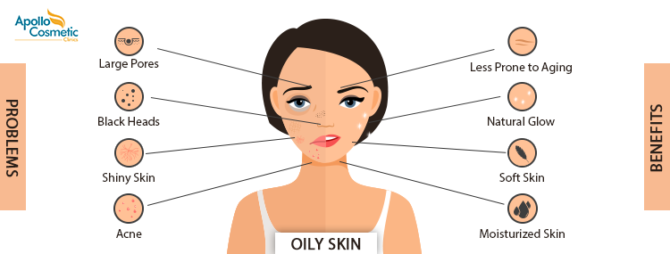 Top skin care tips for Manage oily skin.