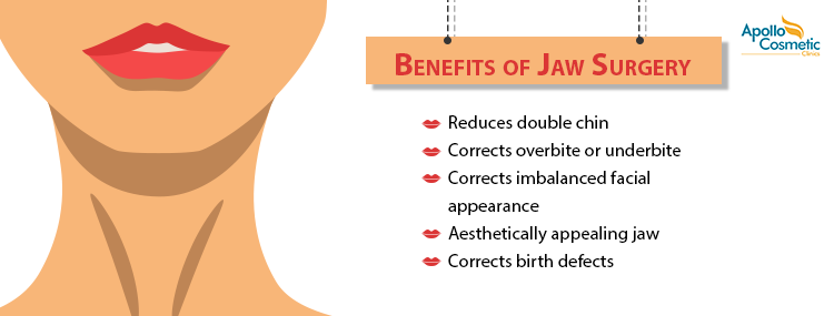 Top 5 benefits of jaw surgery