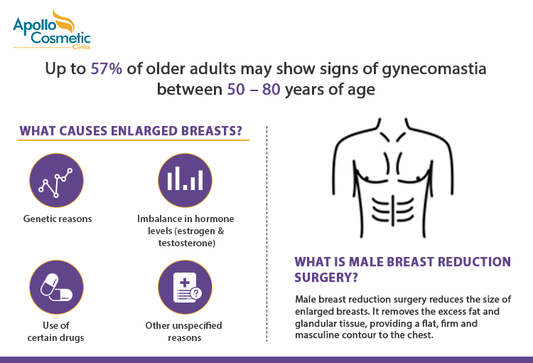 Know more about causes of gynecomastia and what is male breast reduction surgery.