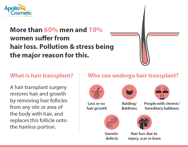 Hair Transplant in Chennai | Apollo Cosmetic Clinics Hair Transplant in Chennai | Apollo Cosmetic Clinics