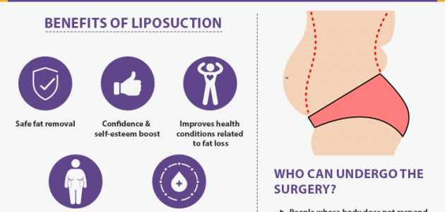 Describing liposuction surgery procedure And it benefits. Eligibility for liposuction surgery.