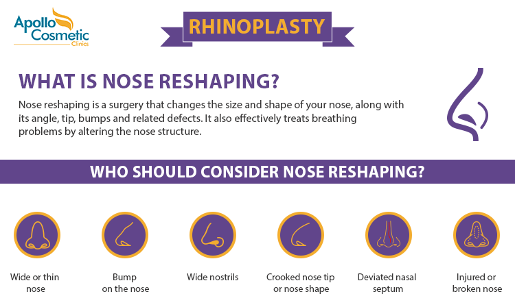 Know more about Rhinoplasty and whether you should consider for undergoing rhinoplasty surgery.