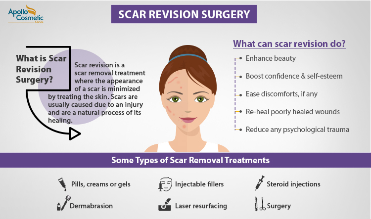 Scar Revision Surgery