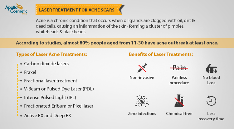 7 Types of Acne Scar Laser Treatments & Their Benefits