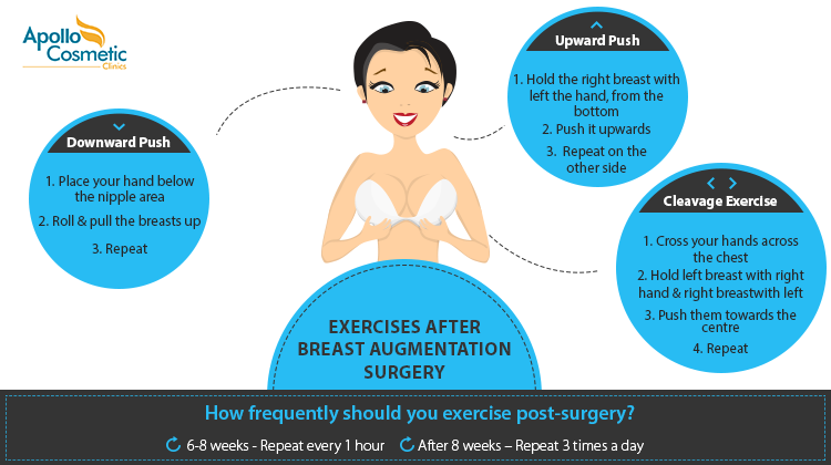 Best exercises after breast augmentation surgery.